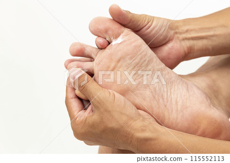 Hands applying medicine to feet on white background 115552113