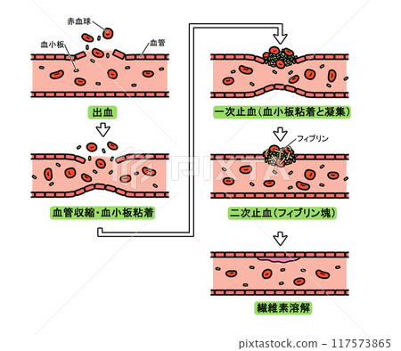 Blood clotting process (with text) 117573865