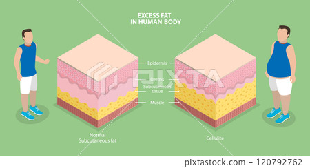 3D Isometric Flat Vector Illustration of Human Body Excess Fat, Obesity 120792762