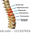 Spine Disorders 121207424