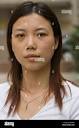 Zhao Yan, 27, one week after an operation to give her double ...