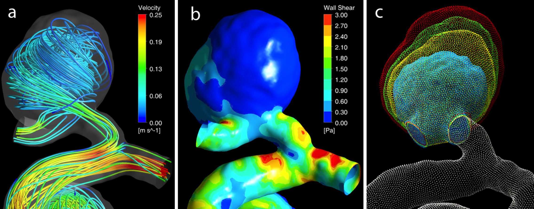 Read more: Cardiovascular Flow Modeling Laboratory - Vitaliy Rayz