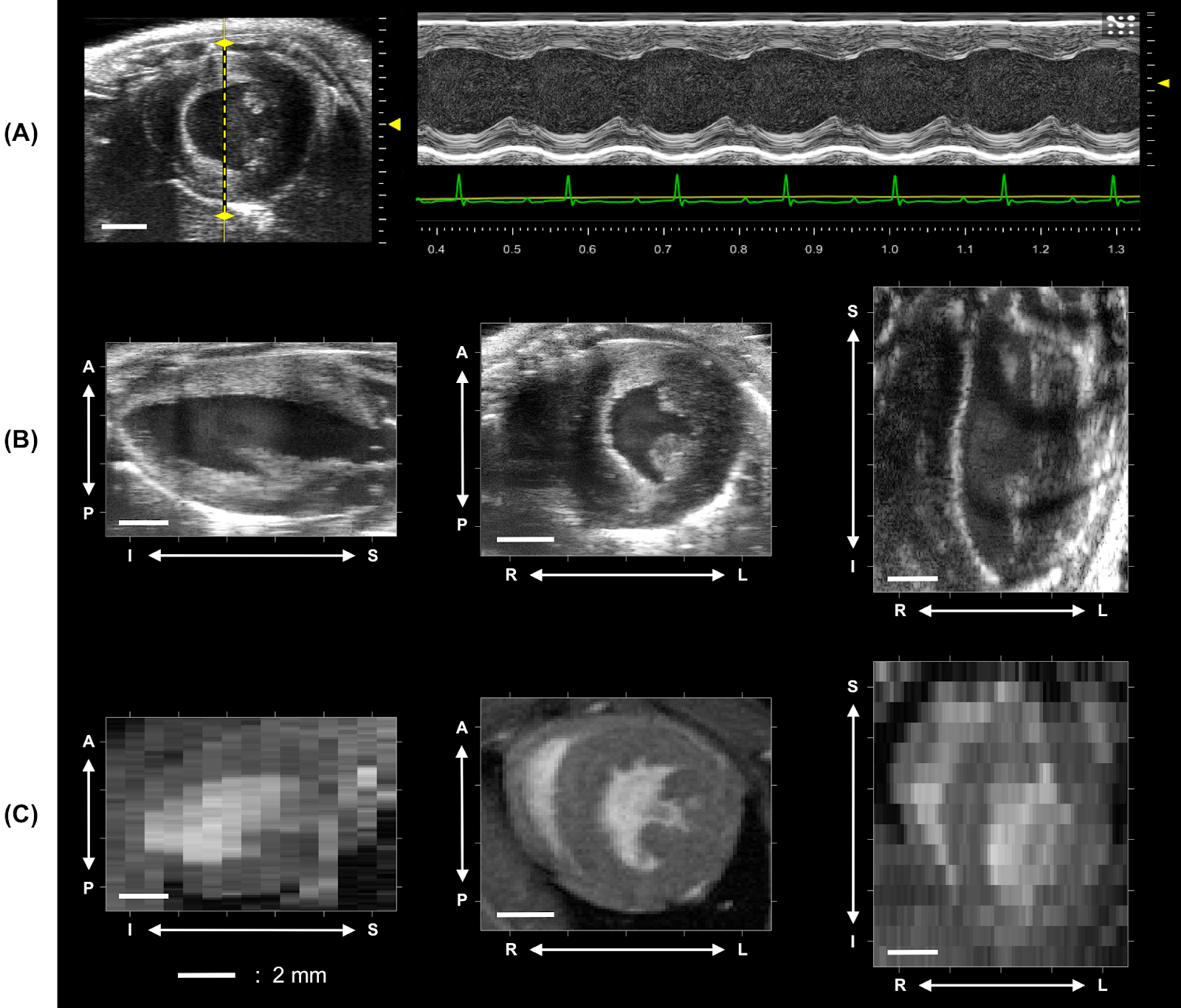 Read more: The Purdue Cardiovascular Imaging Research Laboratory - Craig Goergen 