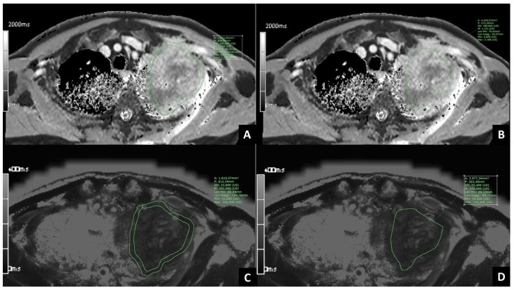 An external file that holds a picture, illustration, etc.
Object name is cancers-15-03252-g002.jpg