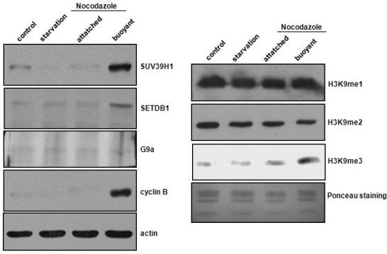 An external file that holds a picture, illustration, etc.
Object name is ksmcb-31-343-g003.jpg