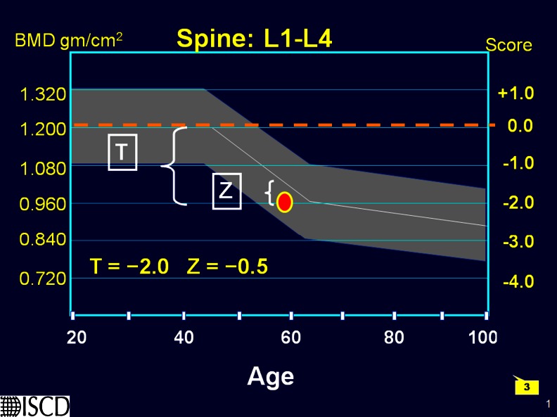 An external file that holds a picture, illustration, etc.
Object name is 198_2014_2794_Fig3_HTML.jpg