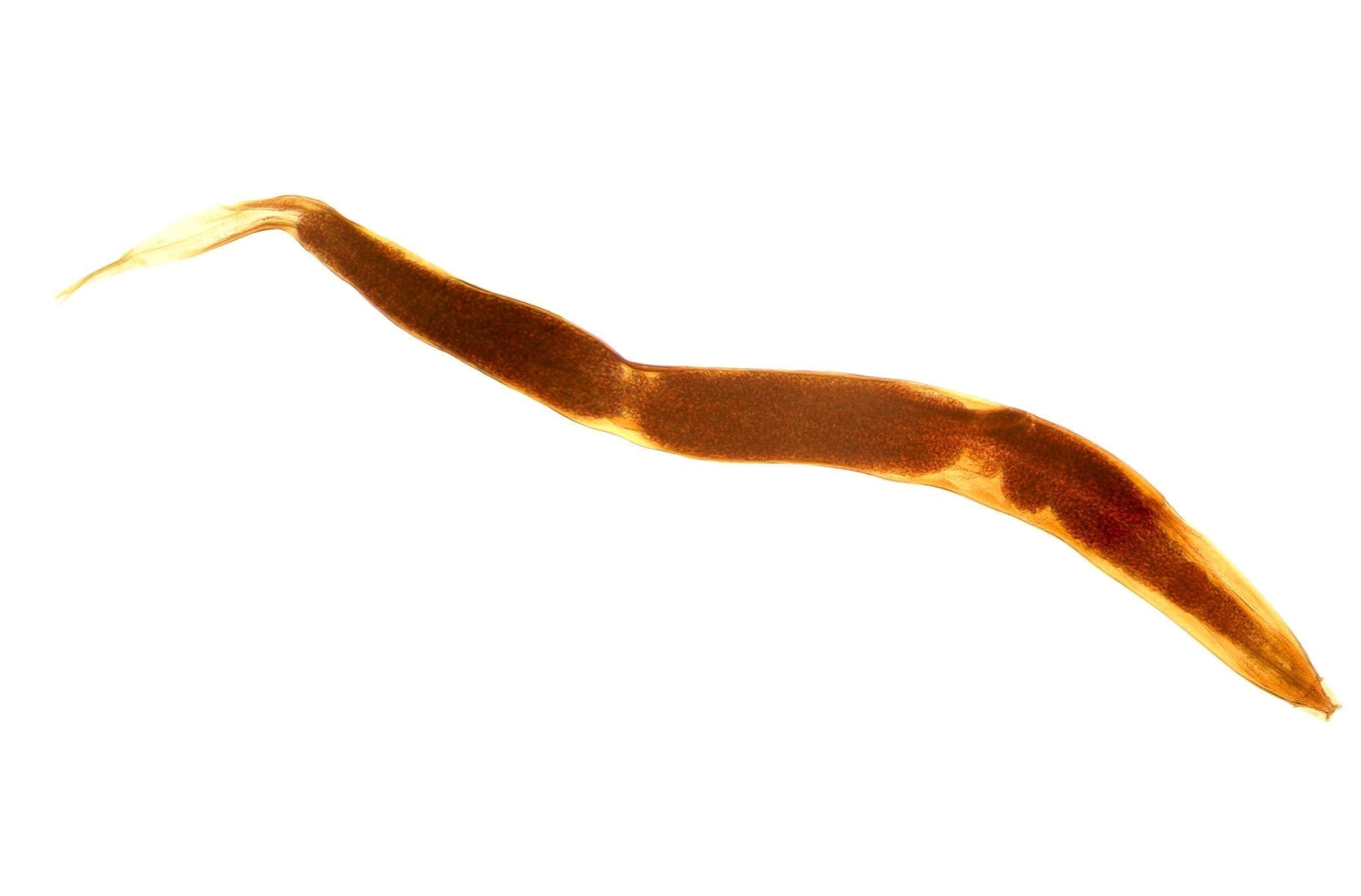 Human Pinworm Stool