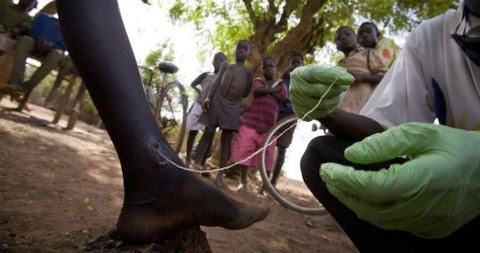 gusano de guinea