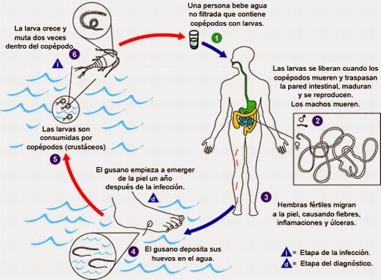 prevención del gusano de guinea