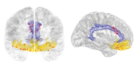 A cross section of the brain highlighting different areas of the brain.