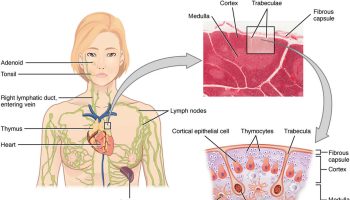 thymoma