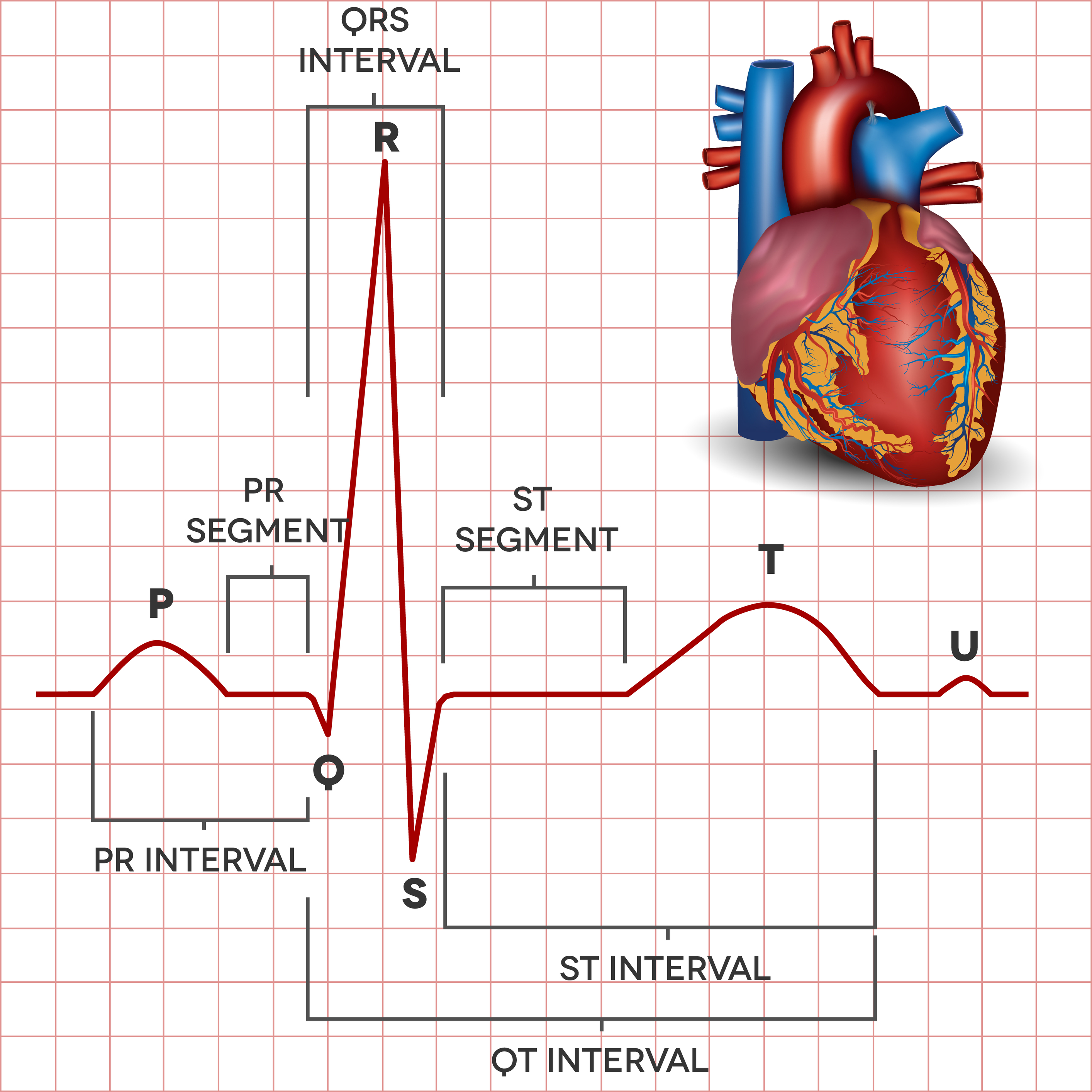 Ekg Parts | Hot Sex Picture