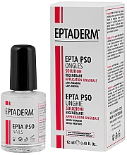 Verstärkende und schützende Nagelbehandlung Eptaderm Epta Pso Nails