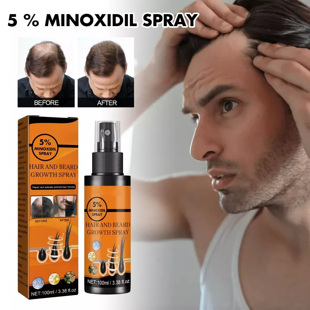 Minoxidil Before And After Men