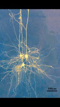 Real picture of neurons.