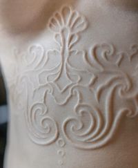 Scarification