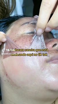 a máscara caseira que está viralizando  no app vizinho por remover todas às manchas de pele usando apenas esses 2 ingredientes. 😱😱 Pele mais lisinha,pele mais brilhante ✨,hidrata a pele,receita caseira para a pele facial,tira manchas da pele,ajuda na remoção de acnes, produto caseiro para a pele