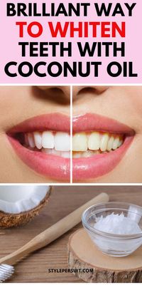 Coconut oil is an effective natural ingredient for teeth whitening. This oil contains lauric acid which helps eliminate bacteria that can cause plaque and teeth discoloration.