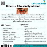 Steven Johnson syndrome