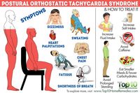 Postural Tachycardia Syndrome symptoms and how to treat it