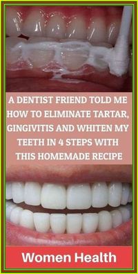 A DENTIST FRIEND TOLD ME HOW TO ELIMINATE TARTAR