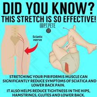 Weak or tight piriformis muscles can lead to a variety of problems, both in sports and in everyday life. Stretching can help alleviate or prevent the pain you can experience from this muscle that lies deep in your buttocks. Learn both simple and advanced piriformis stretches you can use. The piriformis muscle is a deep muscle located beneath the gluteal (butt) muscles that play a surprisingly important role in hip flexibility and stability.