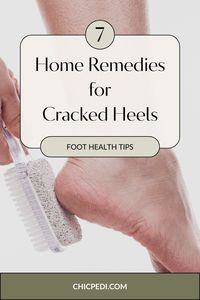 7 Home Remedies for Cracked Heels That Make a Difference. Try Our Cracked Heels Solutions For Healthier Looking Feet.