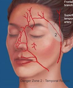 Face Injections, Facial Anatomy, Facial Nerve, Subcutaneous Tissue, Face Anatomy