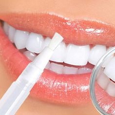 Creative Effective Transparent White Teeth High Strength Whitening Gel Pen Tooth Whitener Bleach PH Neutral D86 Feature - High Strength whitening gel - Use anywhere-fast and convenient application. - Easily brush on for a bright smile. - PH neutral. - Safe to use. Ingredients: Deionized Water, Peroxide, Glycerin, Potassium Sortbate, Ploysorbate 20, Triethanolamine, Carbomer, EDTA Instructions: 1.Brush and floss your teeth. 2.Dry your teeth with a tissue. 3.Twist the bottom of the pen clockwise(t Charcoal Teeth Whitening, Teeth Whitening Pen, Perfect Teeth, Tooth Enamel, Yellow Teeth, Tooth Sensitivity, Best Teeth Whitening, White Smile, Stained Teeth