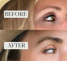 An honest review of the 8 best eyebrow growth serums according to customer reviews and brow experts, plus tips on how to decide which one's right for you. Best Eyebrow Growth Serum, Overplucked Eyebrows, Quick Makeup Routine, Makeup Things