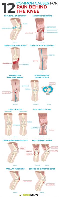 Knee Ligaments, Sciatic Nerve, Joints Pain Relief