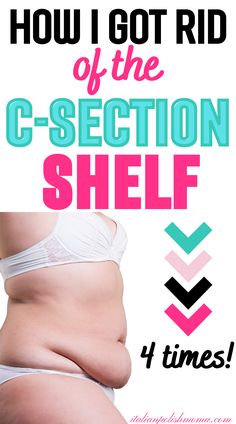 A new mom trying to get rid of her c-section shelf or c-section apron belly and tips to lose it fast. Getting Rid Of Tummy Pooch Lower Belly, Belly Overhang Before And After, Belly Overhang Get Rid Of, Exercises For Tummy Pooch, Get Rid Of Csection Pouch Ab Workouts, Yoga For C Section Recovery, How To Tighten Loose Skin On Stomach After C Section