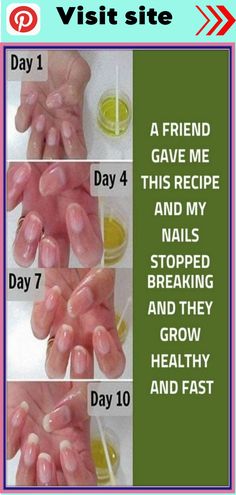 Rub some baking soda on your nails and see what happens? This trick will change your life Strong Nails, Cool Ideas, Healthy Nails, Fitness Beauty, Up Girl, Beauty Secrets, Diy Beauty