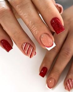 candy cane stipe nails Toe Nail Designs For Christmas, Christmas Nails Square Short, Simple Gel Nails