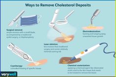 7 Remedies To Get Rid Of Cholesterol Milk Spots Naturally Skin Tissue, Acetic Acid, Stomach Fat, Milk, How To Apply, White, Nature