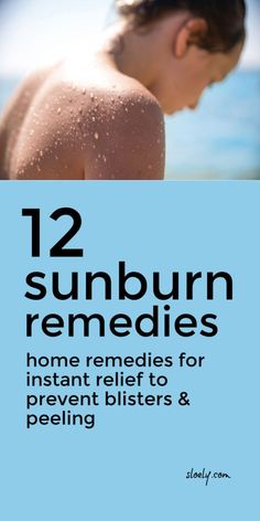 Really Bad Sunburn, Essential Oil For Sunburn, Adulting Tips, Baking Soda Coconut Oil, Natural Antihistamine