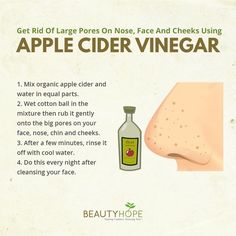 Open Pores On Face, Cheek Acne, Nose Pimples, Blackheads On Nose, How To Get Rid Of Pimples, Beauty Remedies