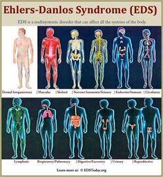 017096efedcc1c8ede7971c3ed094485 Eds Humor, Emergency Book, Ehlers Danlos Syndrome Types, Invisible Disease, Chiari Malformation