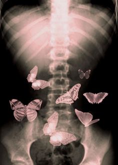 an x - ray image shows butterflies flying in the air over a human body's ribs