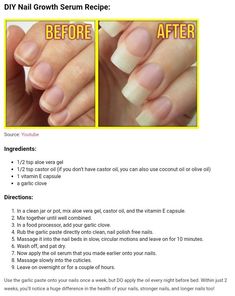 Nail Growth Tips, Nagellack Trends, How To Grow Nails, Nail Growth, Growth Serum, Healthy Nails, Body Skin Care, Diy Beauty