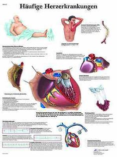 Cardiac Disease, Nursing Mnemonics, Cardiovascular System, Wall Picture, Medical Education, Anatomy And Physiology, Medical Students