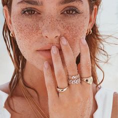 a woman with freckles on her face and hands