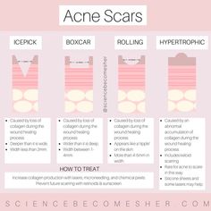 Back Acne Remedies, Acne Scaring, Pimples Under The Skin, Bad Acne, Types Of Acne, Acne Scar, Glow Skin