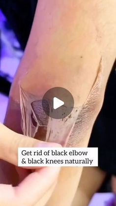 Elbow Black Removal, How To Clean Knees, How To Clean Elbows, Knee Cleaning Tips, Elbow Cleaning Tips, How To Clean Elbows And Knees, How To Remove Black Knees, How To Clean Dark Elbows, Black Knees How To Get Rid Of