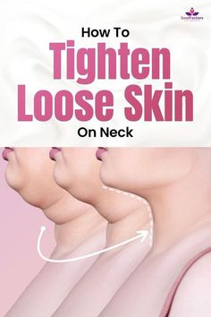 Say Goodbye To Jowls With These Amazing Natural Treatments Saggy Neck Exercises, Skin Tightening Exercises, Get Rid Of Turkey Neck, Saggy Face, Sagging Neck Skin, Loose Neck Skin, Tighten Neck, Tighten Neck Skin, Sagging Cheeks