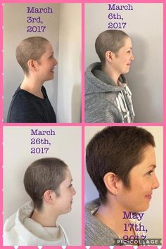 Growing Hair After Chemo, Hair Growth After Chemo, Hair Regrowth Women Remedies, Hair Regrowth Remedies, Grow Natural Hair Faster, Hair Regrowth Women, Hair Regrowth Shampoo, Natural Hair Regrowth, Chemo Hair