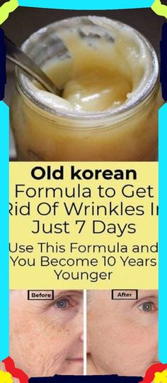 Erase Wrinkles, Natural Healing Remedies, Diy Remedies, Natural Therapy, Natural Cream, Wrinkle Cream, Natural Home Remedies, Years Younger