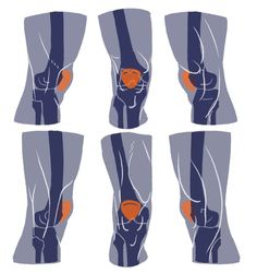 the knee is shown with an orange ball in it's center and four different positions