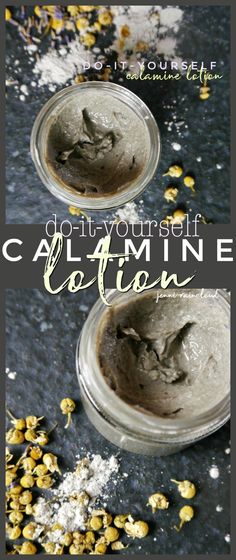 DIY Calamine Lotion - Jenni Raincloud Homemade Calamine Lotion, Itchy Bug Bites, Herbal Skincare, Homemade Skincare, Natural Medicine Cabinet, Witchy Kitchen, Calamine Lotion, Bath Stuff, Lotion Recipe