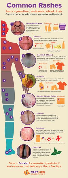 Common Rashes [INFOGRAPHIC] | #skin #itch #rash Skin Assessment Nursing, Boards Exam, Skin Lesions, Integumentary System, Skin Rashes, Endocannabinoid System, Health Topics, Nursing Tips, Wound Care